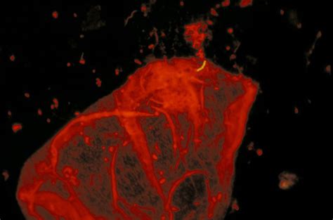 Free picture: mycobacteria tuberculosis, fluorescent, auramine, acridine, orange, counterstain