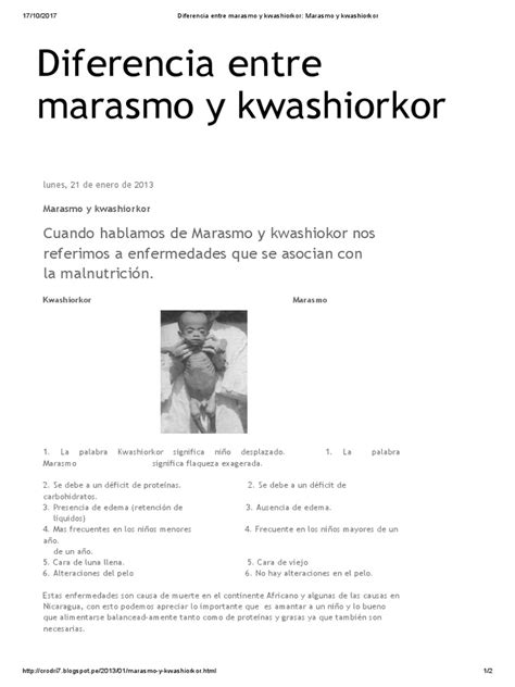 Diferencia Entre Marasmo Y Kwashiorkor Marasmo Y Kwashiorkor Pdf