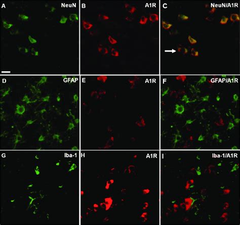 Double Labeling For A1R With NeuN GFAP Or Iba 1 In Lesion Areas In