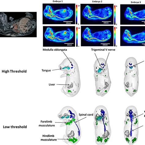 Digital Autoradiography Of Sagittal Sections Of Rat Embryos A And