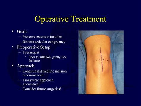 patella fractures extensor mechanism injuriesppt
