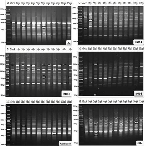 Agarose Gel Electrophoresis 15 In Tbe Buffer Stained With Ethidium Download Scientific