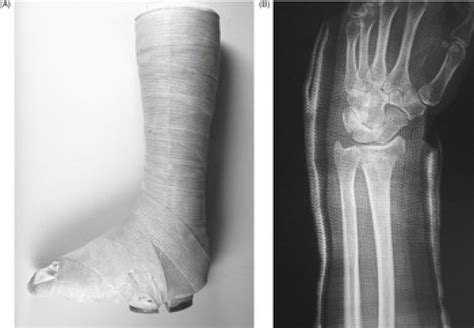 3 Fracture Fixation Radiology Key