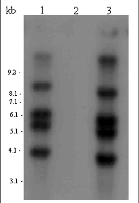 Southern Hybridization Of Genomic Dna From Potato Plants Transformed Download Scientific