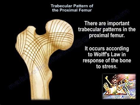 Trabecular Pattern Of The Proximal Femur Everything You Need To Know