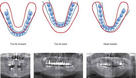 Procedures in Dental Imaging | Pocket Dentistry