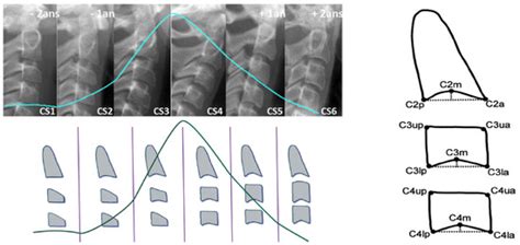 Proceedings Free Full Text Determination Of The Cervical Vertebra Maturation Degree From