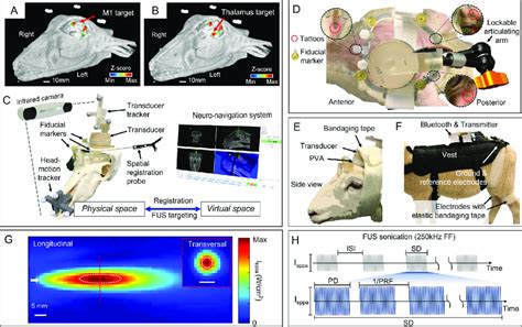 Schematics Of The Experimental Settings With Neuro Navigation Examples