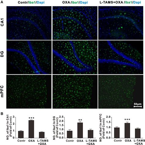 Oral L TAMS Prevents The OXA Induced Microglial Activation In CA1 And