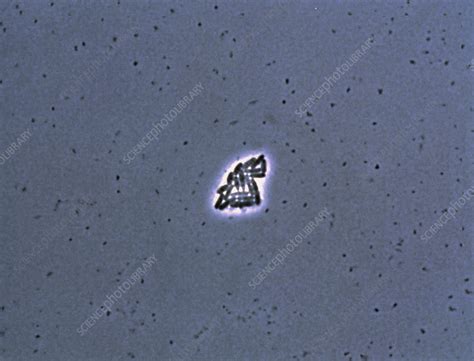 25 E Coli Bacteria Stock Image B230 0176 Science Photo Library