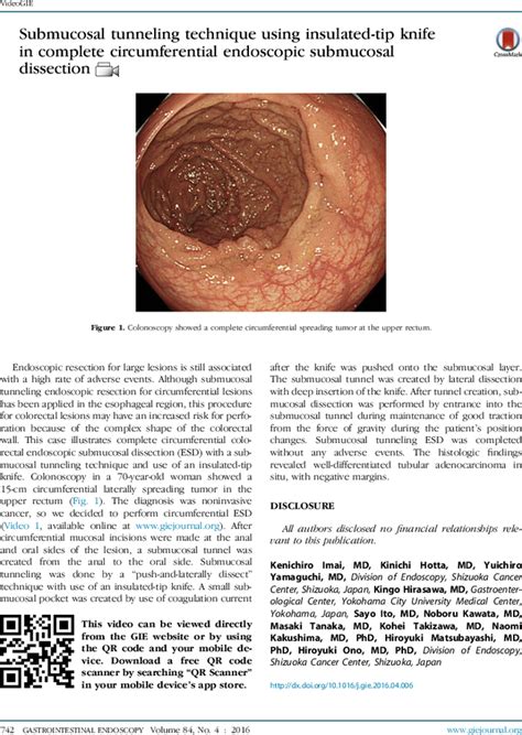 Submucosal Tunneling Technique Using Insulated Tip Knife In Complete Circumferential Endoscopic