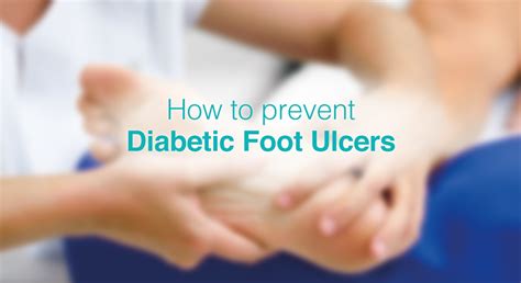 Preventing Diabetic Foot Ulcers Essential Measures And Tips