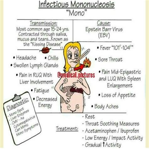 Mononucleosis Symptoms Diagnosis - treesemart