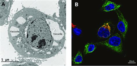 Microscopy Images Of ZIKV Infected HeLa Cells 24 Hours After Infection