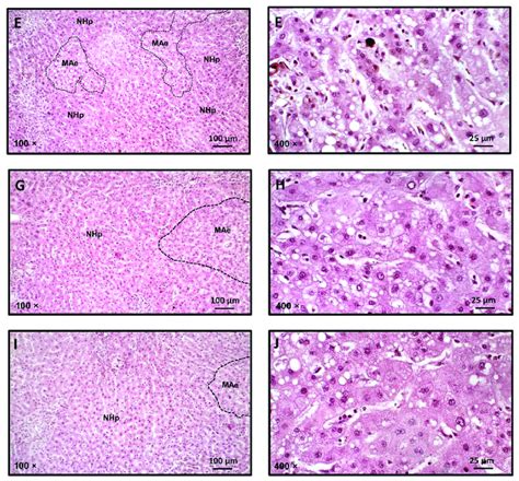 Histological Sections Of HE Stained Samples Of Liver Of The