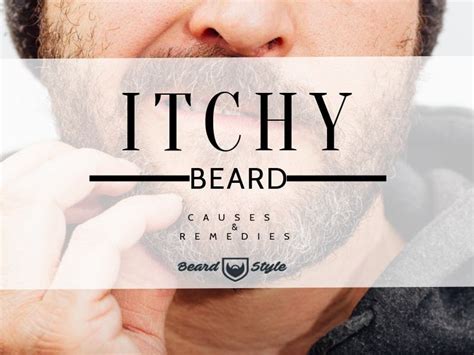 Itchy Beard Causes And How To Get Rid Of It Beardstyle