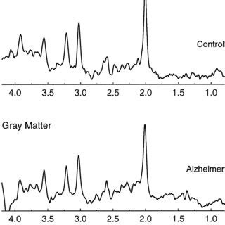 Localized Proton Magnetic Resonance Spectra Stimulated Echo