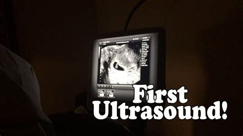 Lesbian Pregnancy Update 6 7 Weeks First Ultrasound YouTube