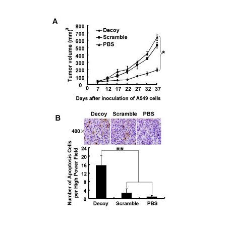 Inhibitory Effect Of STAT3 Decoy ODN On A549 Tumor Bearing Nude Mice