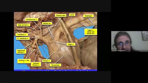 Anatomía topográfica veterinaria U C C Regiones del tórax Parte 3