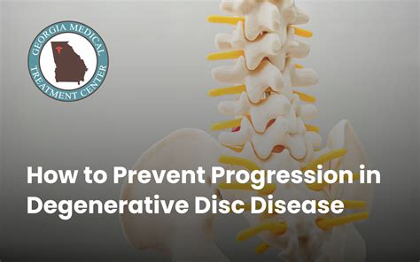 Degenerative Spinal Disc Disease Georgia Medical Treatment Center