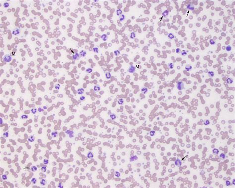 Marked Neutrophilia In A Dog Eclinpath