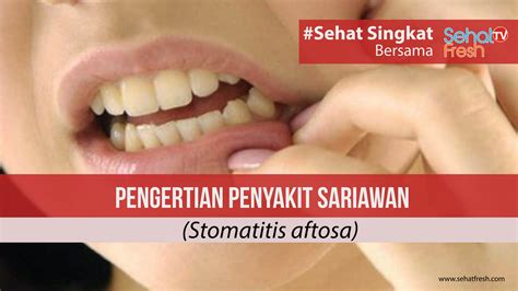 Pengertian Sariawan Sehat Fresh