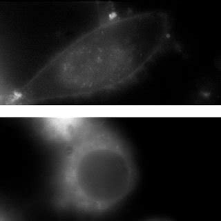 Fluorescence Af And Bright Field Gi Images Of Hela Cells Loaded