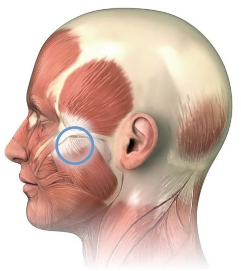 Massage For Jaw Pain Masseter