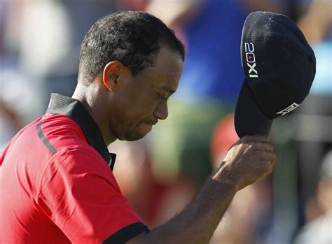 Tiger Woods Going Bald Golfer Admits To Losing Hair Its A No Win