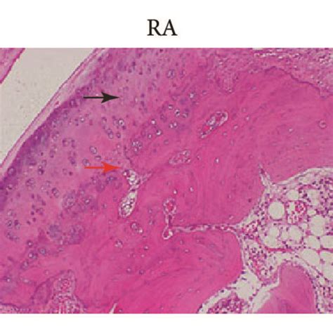 Histological Assessment Cartilage Degradation In Control Ra And