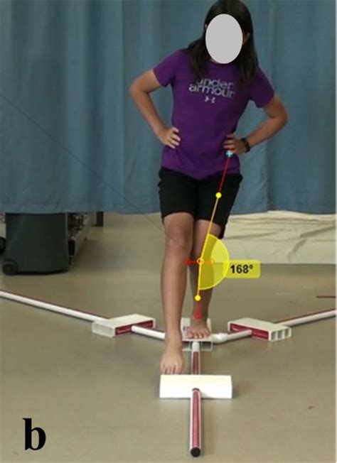 Lower Extremity Kinematics Of The Y Balance Test In Healthy And Acl