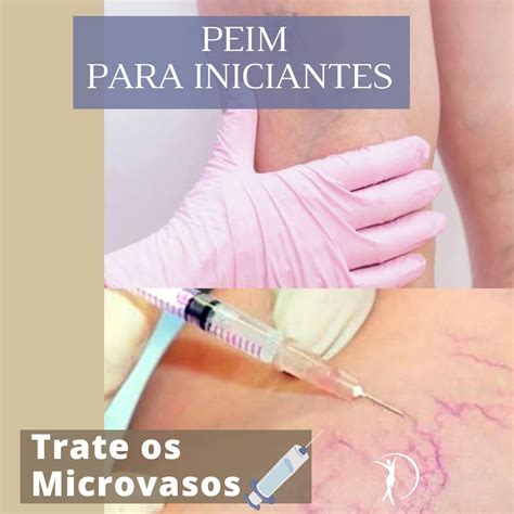 PEIM Procedimento Estético Injetável para Microvasos eBook Terapias