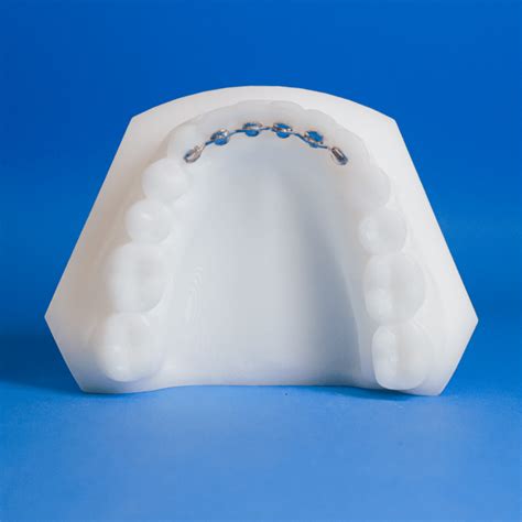 Mesh Fixed Lingual Retainers Specialty Appliances