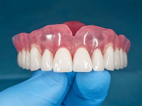 How Much Do Dentures Cost In Alberta Olds Denture Implant Centre