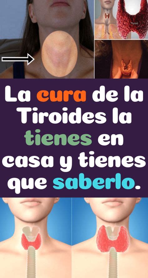 La Cura De La Tiroides La Tienes En Casa Y Tienes Que Saberlo 10