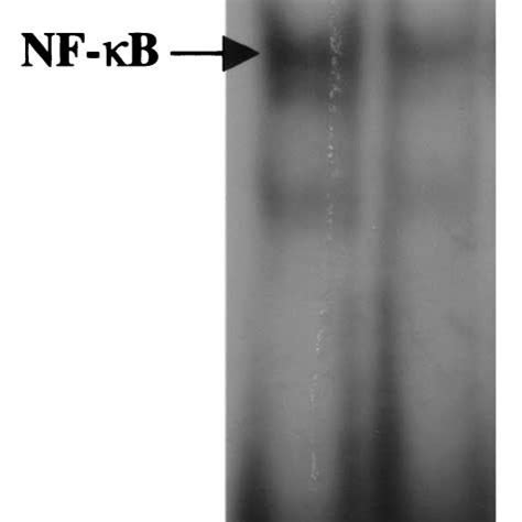 Constitutive Dna Binding Activity Of Nf B In Kb And Kb Cells Nuclear