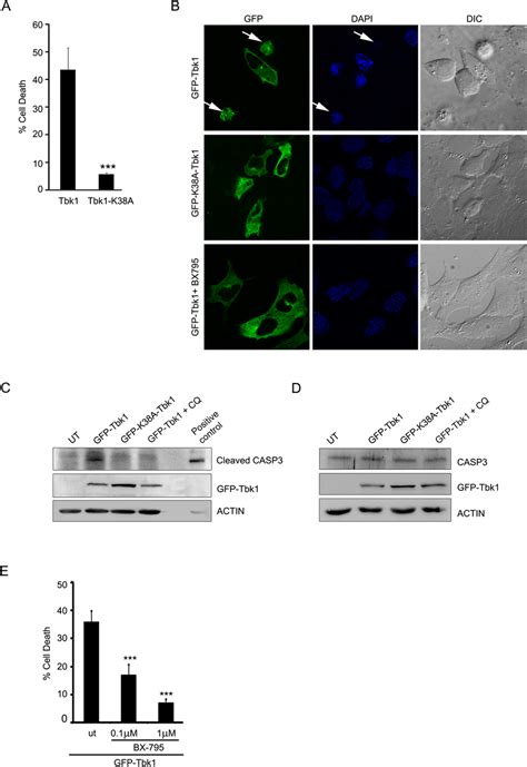 Tbk1 induces cell death in RGC-5 cells dependent on its kinase ...