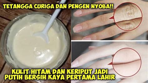 Cara Menghilangkan Keriput Di Tangan Dan Kaki Secara Cepat Youtube