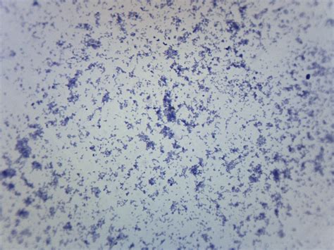 Mycobacterium Tuberculosis Gram Pos Prepared Microscope Slide 7