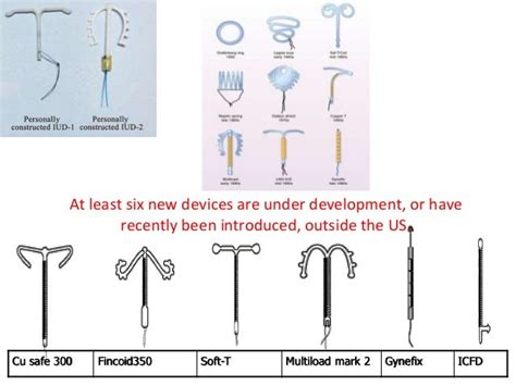 Iud String Color Chart