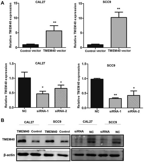 Rt Qpcr And Western Blot Results For Tmem Expression In Cal And