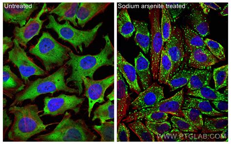 G Bp Antibody Ig Proteintech