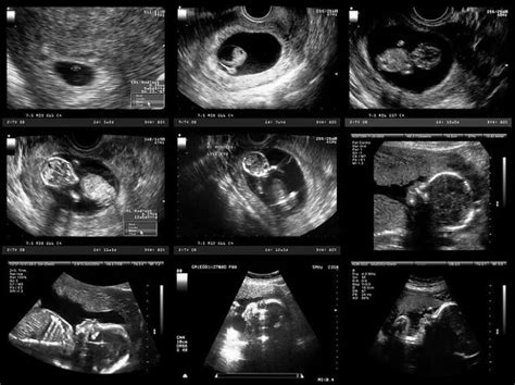 Ultrasound Scans And Imaging Castle Hill Diagnostics