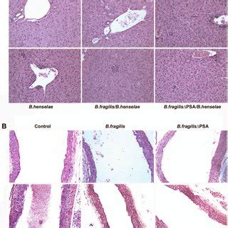 Morphological Analysis Of Murine Coinfected Tissue By Hematoxylin Eosin