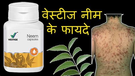 Vestige Neem Capsules Benefits In Hindi Vestige Neem Ke Fayde वेस्टीज नीम के फायदे Youtube