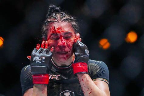 Ufc Before After Photos Of Irene Aldana S Massive Gory Forehead Cut