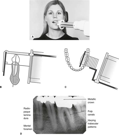 Periapical Radiography Pocket Dentistry