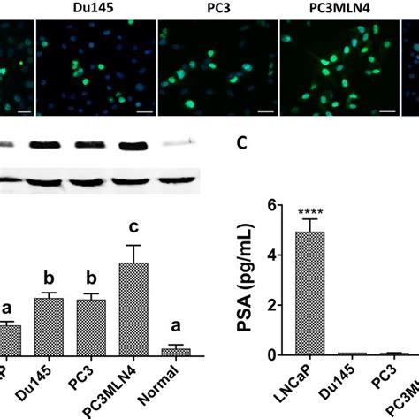 Assessment Of Survivin And Psa Expression In Pca Cells And Primary