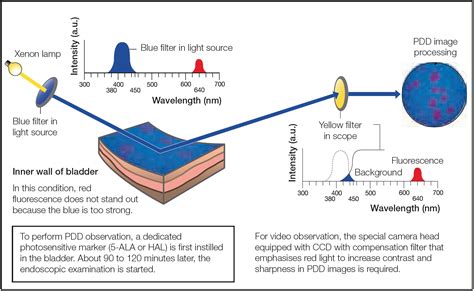 Photodynamic Diagnosis Atlas Vol 1 And 2 Olympus Professional